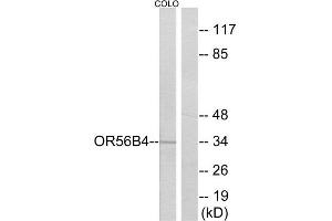 Western Blotting (WB) image for anti-Olfactory Receptor, Family 56, Subfamily B, Member 4 (OR56B4) (C-Term) antibody (ABIN1853150) (OR56B4 antibody  (C-Term))