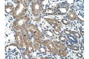 C21ORF7 antibody was used for immunohistochemistry at a concentration of 4-8 ug/ml to stain Epithelial cells of renal tubule (arrows) in Human Kidney. (MAP3K7CL antibody  (C-Term))