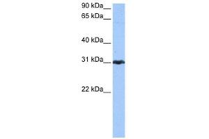 WB Suggested Anti-PRDX3 Antibody Titration: 0. (Peroxiredoxin 3 antibody  (N-Term))