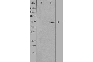Western blot analysis of extracts from COLO205 cells, using HLX1 antibody. (HLX antibody  (Internal Region))