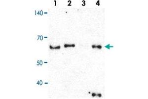 Immunoprecipitation of Lane 1: 5% Input, Lane 2: 5% Sup, Lane 3: Normal IgG and Lane 4: hn-RNPH1 ppt. (HNRNPH1 antibody  (Internal Region))