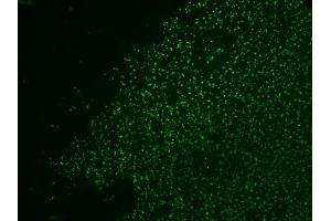 Formalin-fixed, paraffin-embedded human colol carcinoma stained with AF488-conjugated Nucleolin MAb (364-5 + NCL/902). (Nucleolin antibody)