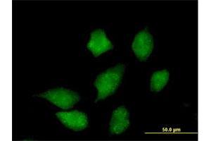 Immunofluorescence of purified MaxPab antibody to CMPK on HeLa cell. (Cytidine Monophosphate (UMP-CMP) Kinase 1, Cytosolic (CMPK1) (AA 1-228) antibody)