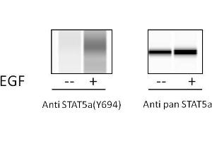 A431 cells were treated or untreated with EGF. (STAT5A ELISA Kit)