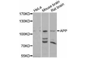 Western blot analysis of extracts of various cell lines, using APP antibody (ABIN5997248) at 1/1000 dilution.