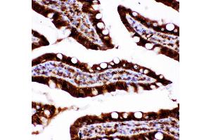 Anti-Caspase3 antibody, IHC(P) IHC(P): Rat Intestine Tissue (Caspase 3 antibody  (AA 67-175))