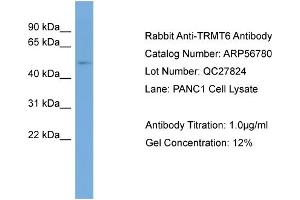 WB Suggested Anti-TRMT6  Antibody Titration: 0. (TRMT6 antibody  (Middle Region))