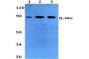 Western Blot (WB) analysis of CD124 / IL4R antibody at 1/500 dilution. (IL4 Receptor antibody)