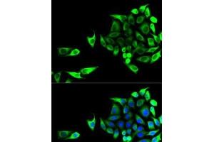 Immunofluorescence analysis of U2OS cells using GOT1 Polyclonal Antibody
