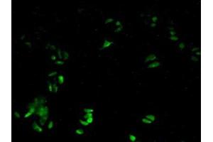 Detection of PRDX6 in Human Hela Cells using Polyclonal Antibody to Peroxiredoxin 6 (PRDX6) (Peroxiredoxin 6 antibody  (AA 1-224))
