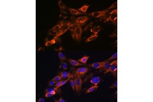 Immunofluorescence analysis of NIH-3T3 cells using Src Rabbit mAb (ABIN7269727) at dilution of 1:100 (40x lens). (Src antibody)