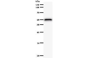 Western Blotting (WB) image for anti-Lysine (K)-Specific Demethylase 4A (KDM4A) antibody (ABIN932195) (KDM4A antibody)