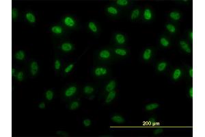 Immunofluorescence of monoclonal antibody to SIX4 on HeLa cell. (SIX4 antibody  (AA 672-780))