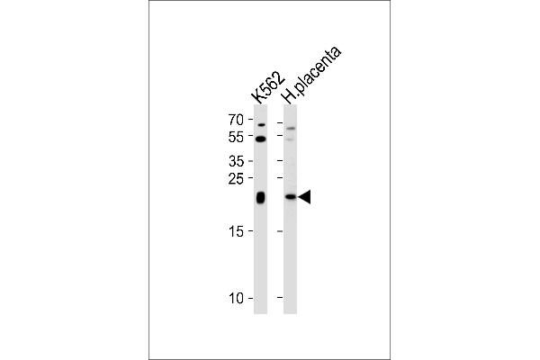 IL-31 anticorps  (N-Term)