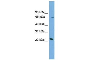 WB Suggested Anti-Foxn2 Antibody Titration:  0. (FOXN2 antibody  (N-Term))