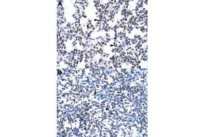 Immunohistochemical staining (Formalin-fixed paraffin-embedded sections) of human lung (A) and human spleen (B) with GCM1 polyclonal antibody  at 4-8 ug/mL working concentration. (GCM1 antibody  (N-Term))