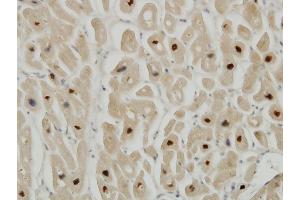 Immunoperoxidase of monoclonal antibody to TTN on formalin-fixed paraffin-embedded human heart. (Titin antibody  (AA 1-110))