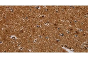 PNOC antibody