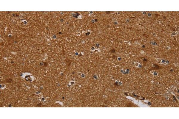 PNOC antibody