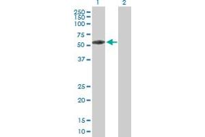 Western Blot analysis of KBTBD9 expression in transfected 293T cell line by KBTBD9 MaxPab polyclonal antibody. (KLHL29 antibody  (AA 1-503))