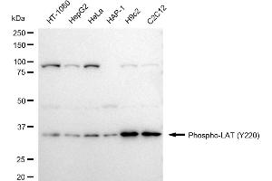 Western blotting analysis using phospho-LAT (Y220) antibody (ABIN7799271).