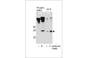 Western blot analysis of extracts from Jurkat cells,untreated or treated with paclitaxel,using phospho-Bcl2(Ser70)(left) or Bcl2 Antibody (right). (Bcl-2 antibody  (pSer70))