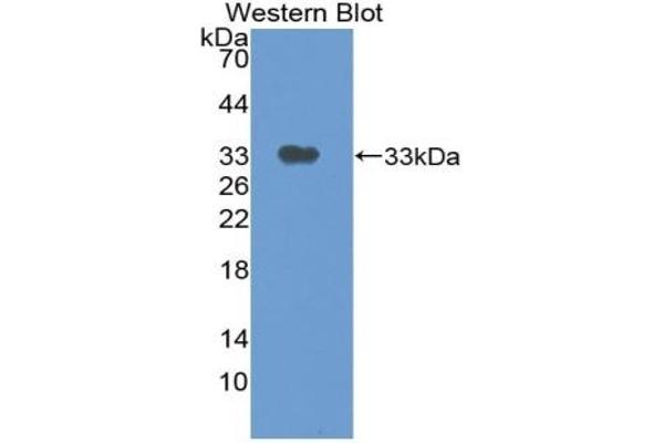 Thymidine Phosphorylase antibody  (AA 29-305)