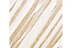 Immunohistochemistry (IHC) image for anti-Myosin, Light Chain 1, Alkali, Skeletal, Fast (MYL1) (Light Chain) antibody (ABIN7795614)
