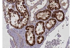 ABIN6272848 at 1/100 staining human kidney tissue sections by IHC-P. (CPT1A antibody  (Internal Region))