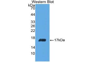 Western blot analysis of the recombinant protein. (IL-5 antibody  (AA 20-134))