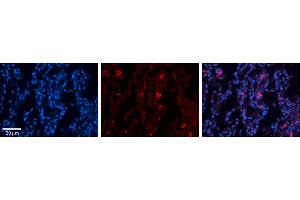 Rabbit Anti-FBXO21 Antibody     Formalin Fixed Paraffin Embedded Tissue: Human Lung Tissue  Observed Staining: Membrane and cytoplasmic in alveolar type I cells  Primary Antibody Concentration: 1:100  Other Working Concentrations: 1/600  Secondary Antibody: Donkey anti-Rabbit-Cy3  Secondary Antibody Concentration: 1:200  Magnification: 20X  Exposure Time: 0. (FBXO21 antibody  (N-Term))