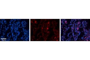 Rabbit Anti-FBXO21 Antibody     Formalin Fixed Paraffin Embedded Tissue: Human Lung Tissue  Observed Staining: Membrane and cytoplasmic in alveolar type I cells  Primary Antibody Concentration: 1:100  Other Working Concentrations: 1/600  Secondary Antibody: Donkey anti-Rabbit-Cy3  Secondary Antibody Concentration: 1:200  Magnification: 20X  Exposure Time: 0.