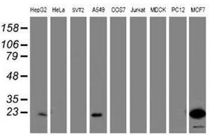 Image no. 7 for anti-PYD and CARD Domain Containing (PYCARD) antibody (ABIN1500518)