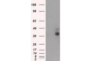 HEK293T cells were transfected with the pCMV6-ENTRY control (Left lane) or pCMV6-ENTRY BSG (Right lane) cDNA for 48 hrs and lysed. (CD147 antibody)
