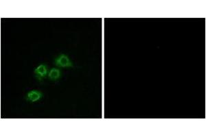 Immunofluorescence analysis of MCF7 cells, using GPR1 Antibody. (G Protein-Coupled Receptor 1 antibody  (AA 121-170))