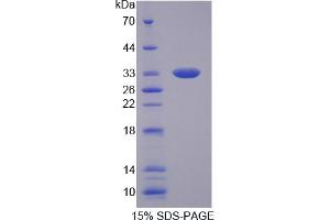 Image no. 1 for Tumor Necrosis Factor-Inducible Protein 6 (TNFAIP6) (AA 18-275) protein (His tag) (ABIN4990997)