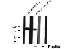 JUP antibody  (C-Term)