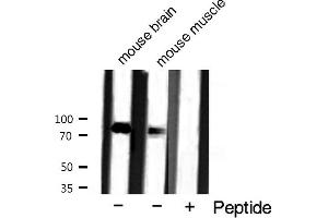 Western blot analysis of Catenin-γ expression in mouse tissue extract (JUP antibody  (C-Term))