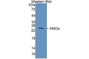 Western blot analysis of the recombinant protein. (ACADS antibody  (AA 210-396))