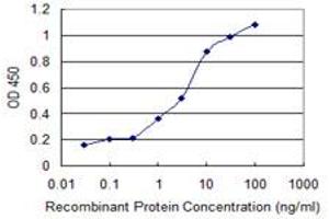 Detection limit for recombinant GST tagged RCBTB2 is 0. (RCBTB2 antibody  (AA 86-194))