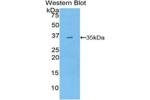 Western Blotting (WB) image for anti-Pyruvate Dehydrogenase Kinase, Isozyme 4 (PDK4) (AA 117-387) antibody (ABIN3207487) (PDK4 antibody  (AA 117-387))