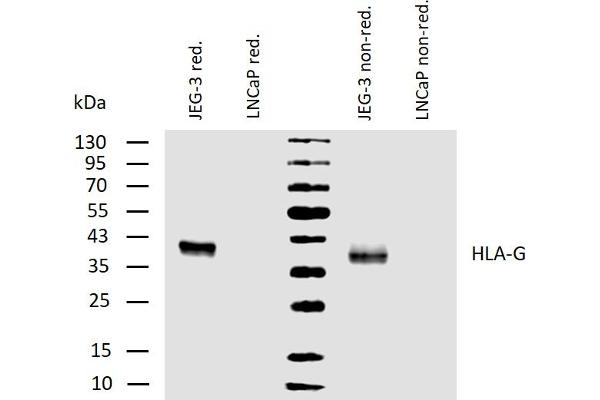 HLAG antibody