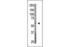 Western Blotting (WB) image for anti-CAMP Responsive Element Binding Protein 3-Like 1 (CREB3L1) (AA 490-519), (C-Term) antibody (ABIN358719) (CREB3L1 antibody  (C-Term))