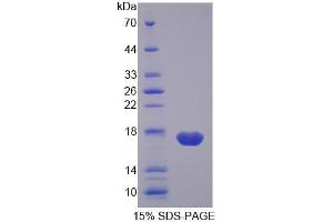 SDS-PAGE (SDS) image for Fatty Acid Binding Protein 2, Intestinal (FABP2) (AA 4-129) protein (His tag) (ABIN6239039) (FABP2 Protein (AA 4-129) (His tag))