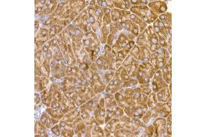 Immunohistochemistry (IHC) image for anti-Eukaryotic Translation Initiation Factor 1A (EIF1A) antibody (ABIN7267027)