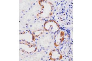 A staining HHLA2 in human kidney tissue sections by Immunohistochemistry (IHC-P - paraformaldehyde-fixed, paraffin-embedded sections).