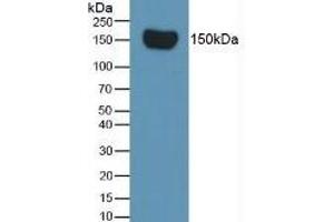 Mouse Capture antibody from the kit in WB with Positive Control: Sample Rat Serum. (Complement Factor H ELISA Kit)