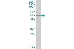 PHF1 monoclonal antibody (M02), clone 4D8 Western Blot analysis of PHF1 expression in K-562 .