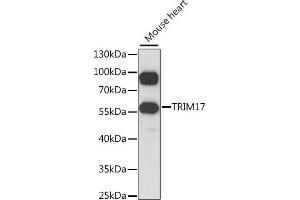 Western blot analysis of extracts of mouse heart, using TRIM17 antibody  at 1:1000 dilution. (TRIM17 / RNF16 antibody  (AA 1-300))