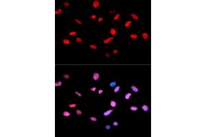 Immunofluorescence analysis of U2OS cells using Phospho-Rb-S811 antibody. (Retinoblastoma 1 antibody  (pSer811))